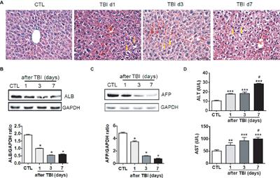 Transient Inhibition of mTORC1 Signaling Ameliorates Irradiation-Induced Liver Damage